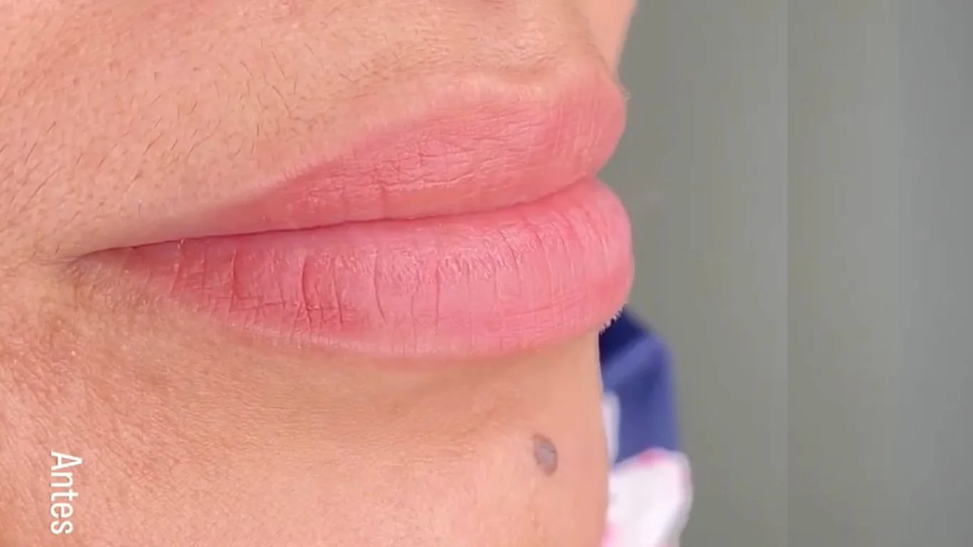 labios antes (micropigmentación)