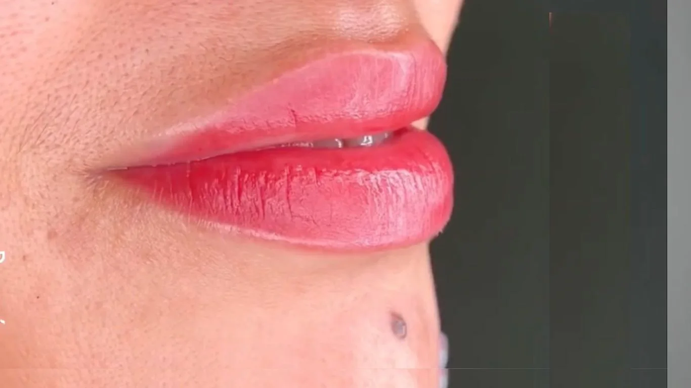 labios después (micropigmentación)